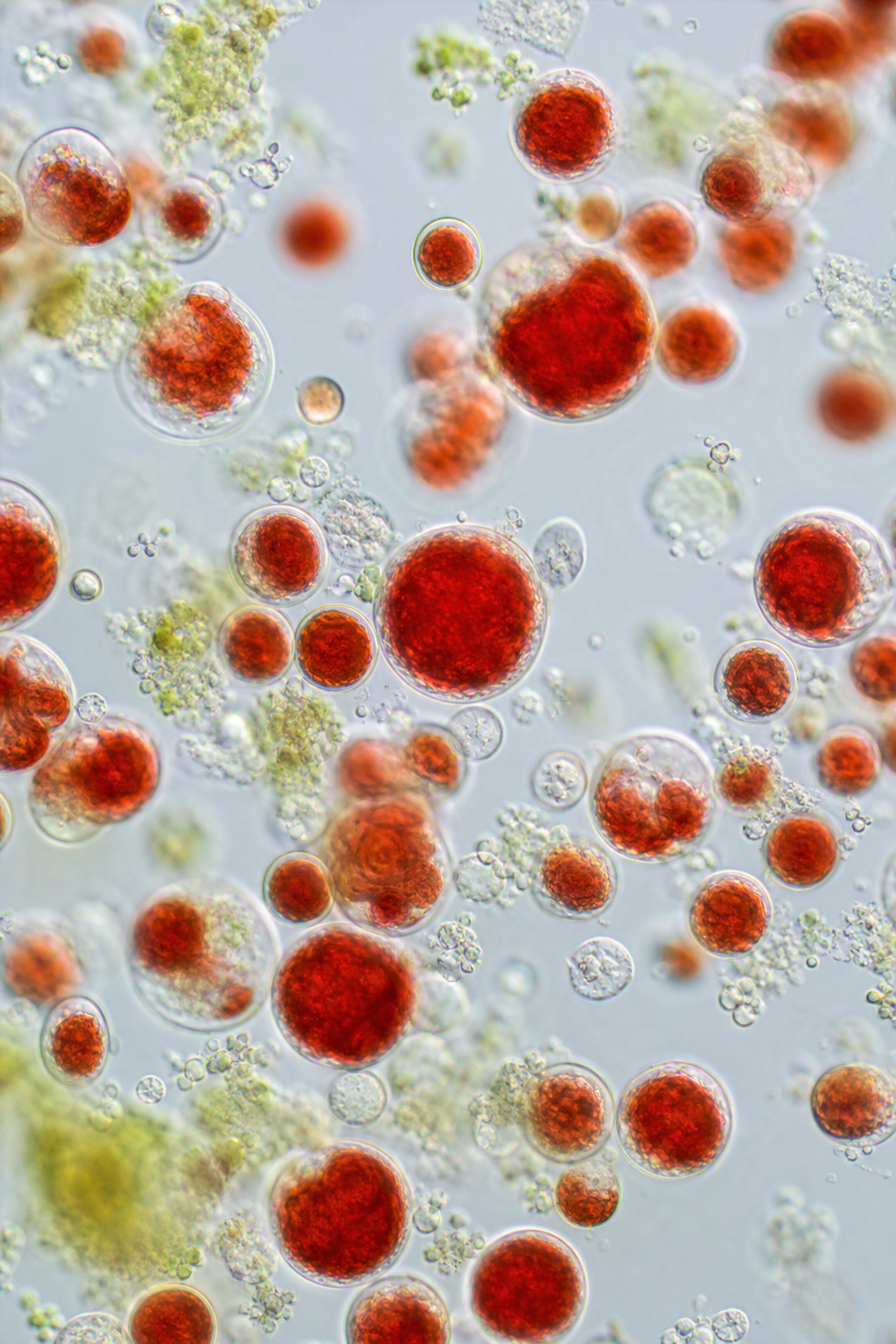Best Places to Buy Astaxanthin Eye Supplements (2026)